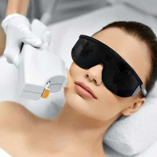 IPL/Laser Photorejuvenation