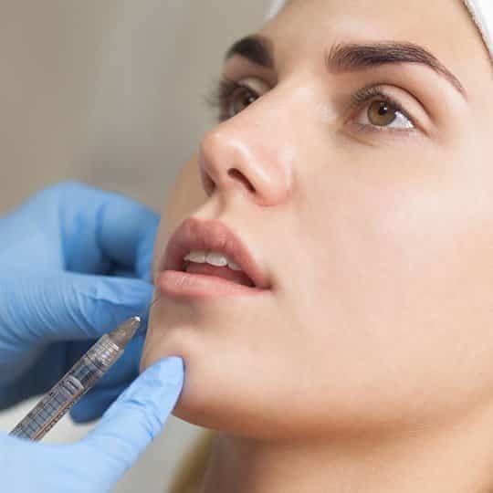LIP FILLERS