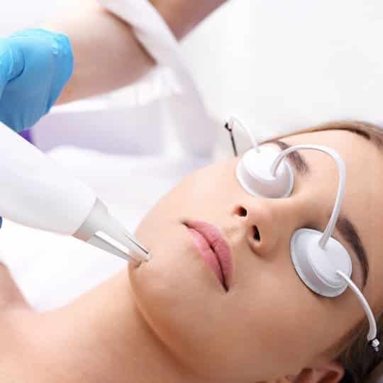 ND:YAG Laser